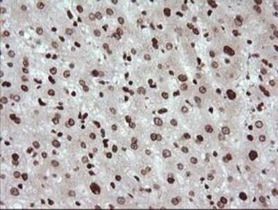 Immunohistochemistry: TRIM38 Antibody (OTI113D3) - Azide and BSA Free [NBP2-74610]