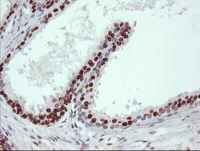 Immunohistochemistry: TRIM38 Antibody (OTI113D3) - Azide and BSA Free [NBP2-74610]