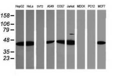 Western Blot: TRIM38 Antibody (OTI113D3)Azide and BSA Free [NBP2-74610]