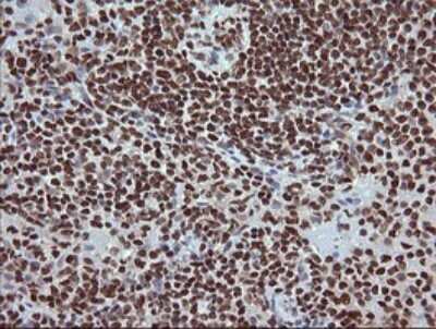 Immunohistochemistry: TRIM38 Antibody (OTI113D3) [NBP2-46215]