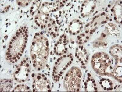 Immunohistochemistry: TRIM38 Antibody (OTI113D3) [NBP2-46215]