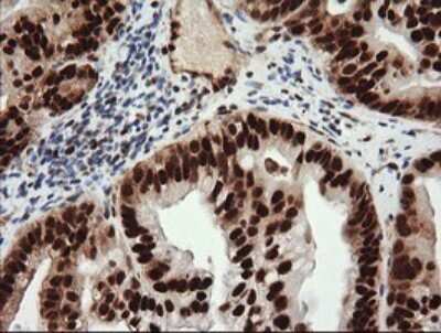 Immunohistochemistry: TRIM38 Antibody (OTI113D3) [NBP2-46215]