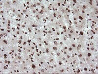 Immunohistochemistry: TRIM38 Antibody (OTI113D3) [NBP2-46215]