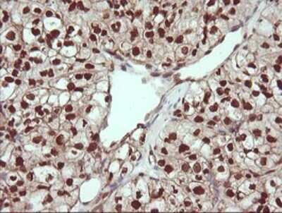 Immunohistochemistry: TRIM38 Antibody (OTI113D3) [NBP2-46215]