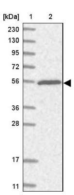 Western Blot: TRIM38 Antibody [NBP1-87126]