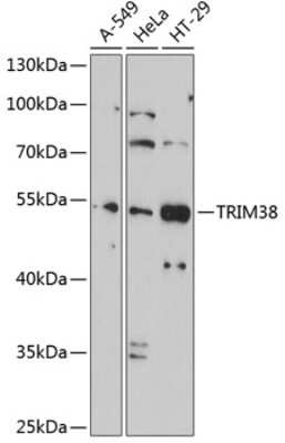 Western Blot: TRIM38 AntibodyBSA Free [NBP2-93955]