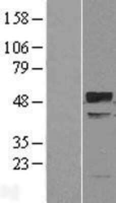 Western Blot: TRIM38 Overexpression Lysate [NBL1-17294]