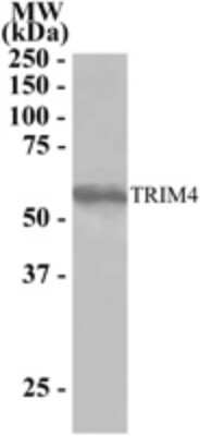 Western Blot: TRIM4 Antibody [NB100-1225]