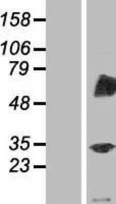 Western Blot: TRIM4 Overexpression Lysate [NBP2-05920]