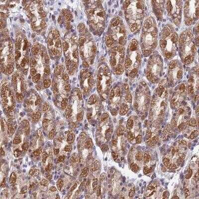 Immunohistochemistry-Paraffin: TRIM40 Antibody [NBP1-92530]