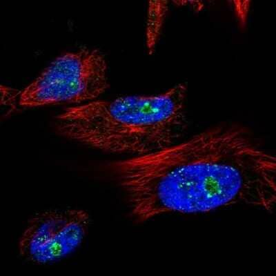 Immunocytochemistry/ Immunofluorescence: TRIM41 Antibody [NBP1-81227]