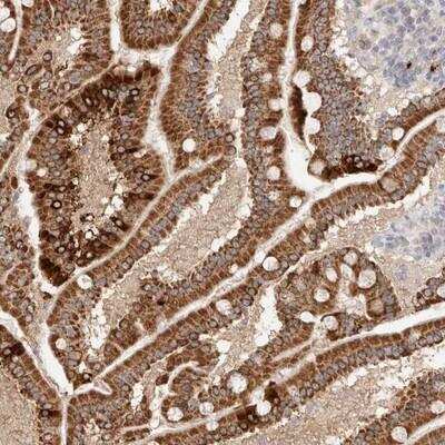 Immunohistochemistry: TRIM41 Antibody [NBP1-81227]
