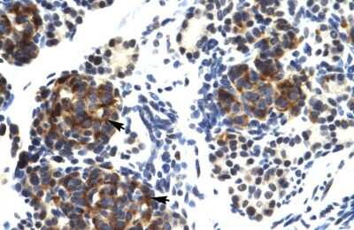 Immunohistochemistry: TRIM41 Antibody [NBP2-85988]