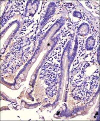 Immunohistochemistry-Paraffin: TRIM41 Antibody - BSA Free [NBP3-05293]