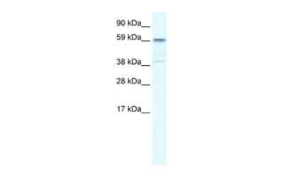 Western Blot: TRIM41 Antibody [NBP2-85988]