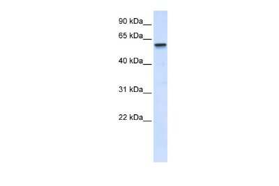 Western Blot: TRIM41 Antibody [NBP2-85990]