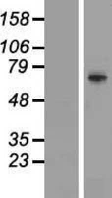 Western Blot: TRIM41 Overexpression Lysate [NBP2-05851]