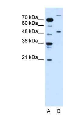 Western Blot: TRIM42 Antibody [NBP1-55074]