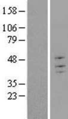 Western Blot: TRIM43 Overexpression Lysate [NBL1-17298]