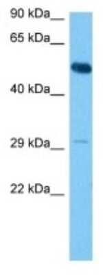 Western Blot: TRIM43A Antibody [NBP3-10223]