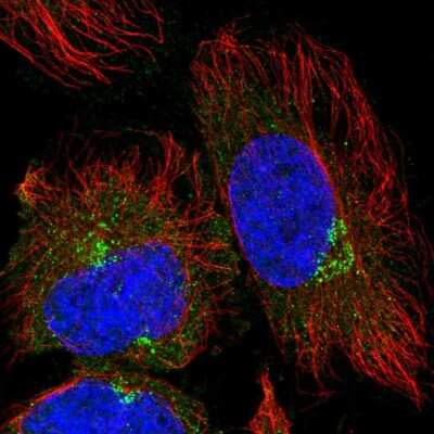 Immunocytochemistry/ Immunofluorescence: TRIM44 Antibody [NBP2-55318]