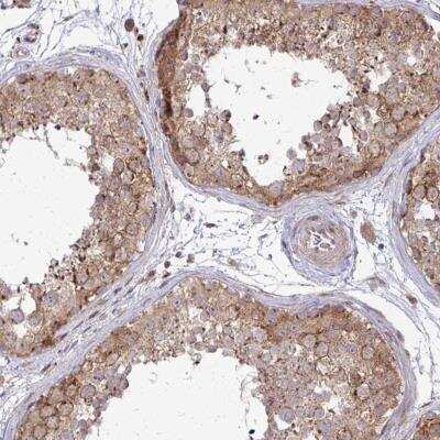 Immunohistochemistry-Paraffin: TRIM44 Antibody [NBP2-31681]