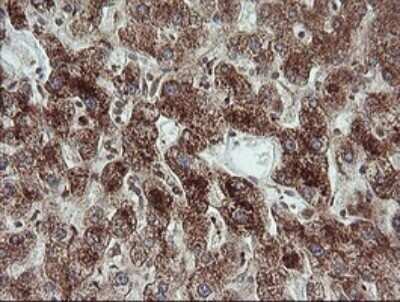 Immunohistochemistry: TRIM44 Antibody (OTI1E10) - Azide and BSA Free [NBP2-74611]