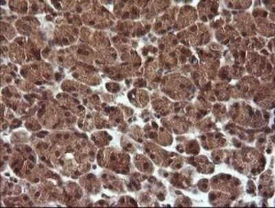 Immunohistochemistry: TRIM44 Antibody (OTI1E10) - Azide and BSA Free [NBP2-74611]
