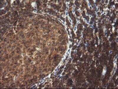 Immunohistochemistry: TRIM44 Antibody (OTI1E10) - Azide and BSA Free [NBP2-74611]