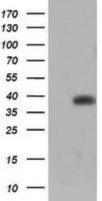 Western Blot: TRIM44 Antibody (OTI1E10)Azide and BSA Free [NBP2-74611]