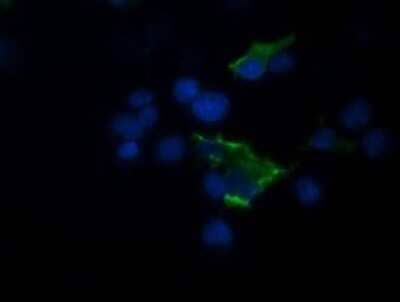 Immunocytochemistry/ Immunofluorescence: TRIM44 Antibody (OTI1E10) [NBP2-46222]