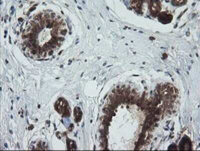 Immunohistochemistry: TRIM44 Antibody (OTI1E10) [NBP2-46222]