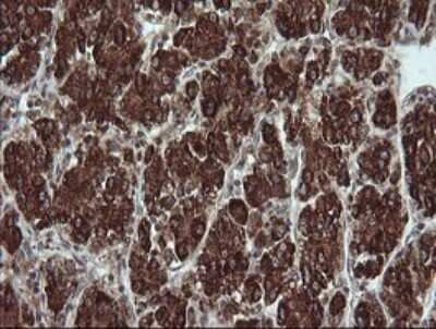 Immunohistochemistry: TRIM44 Antibody (OTI1E10) [NBP2-46222]