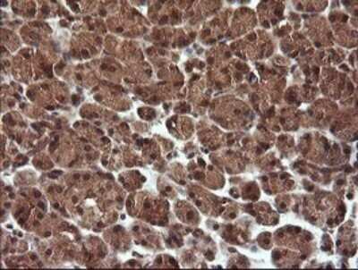 Immunohistochemistry: TRIM44 Antibody (OTI1E10) [NBP2-46222]