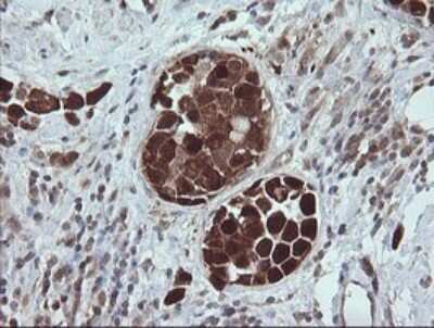Immunohistochemistry: TRIM44 Antibody (OTI1E10) [NBP2-46222]