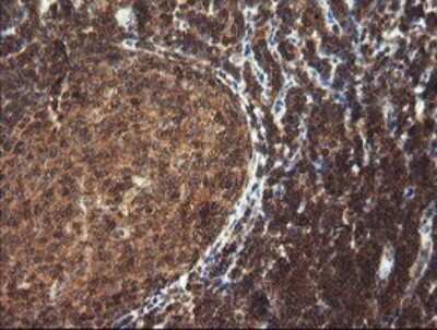 Immunohistochemistry: TRIM44 Antibody (OTI1E10) [NBP2-46222]