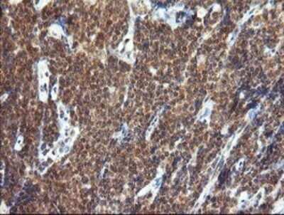 Immunohistochemistry: TRIM44 Antibody (OTI1E10) [NBP2-46222]