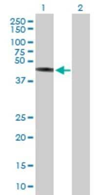 Western Blot: TRIM44 Antibody [H00054765-B01P]