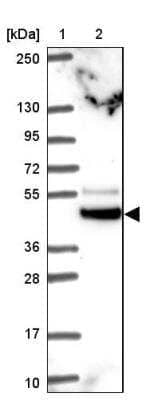 Western Blot: TRIM44 Antibody [NBP2-31681]