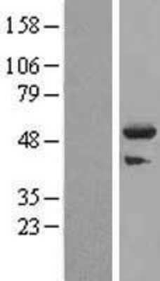 Western Blot: TRIM44 Overexpression Lysate [NBL1-17299]