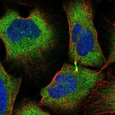 Immunocytochemistry/ Immunofluorescence: TRIM45 Antibody [NBP2-55311]