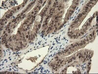 Immunohistochemistry: TRIM45 Antibody (OTI3G3) - Azide and BSA Free [NBP2-74612]