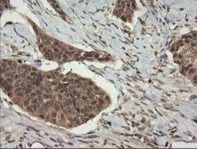 Immunohistochemistry: TRIM45 Antibody (OTI3G3) - Azide and BSA Free [NBP2-74612]