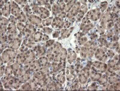 Immunohistochemistry: TRIM45 Antibody (OTI3G3) - Azide and BSA Free [NBP2-74612]