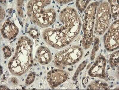 Immunohistochemistry: TRIM45 Antibody (OTI3G3) [NBP2-46223]