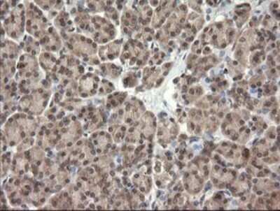 Immunohistochemistry: TRIM45 Antibody (OTI3G3) [NBP2-46223]
