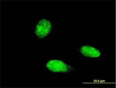 Immunocytochemistry/ Immunofluorescence: TRIM46 Antibody (3G11) [H00080128-M05]