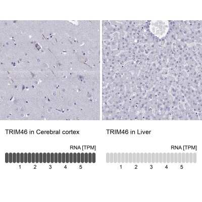 Immunohistochemistry-Paraffin: TRIM46 Antibody [NBP2-62626]