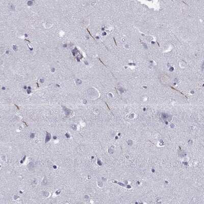 Immunohistochemistry-Paraffin: TRIM46 Antibody [NBP2-62626]