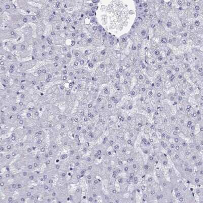 Immunohistochemistry-Paraffin: TRIM46 Antibody [NBP2-62626]